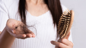 Indeseado efecto: El estrés y el Covid les dejan sin cabello