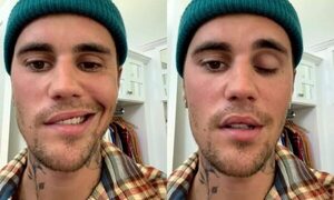 Justin Bieber muestra primeros signos de recuperación tras su parálisis facial