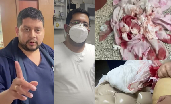Falleció abuelita que fue encontrada desangrada por sus familiares en el IPS de Coronel Oviedo - Noticiero Paraguay