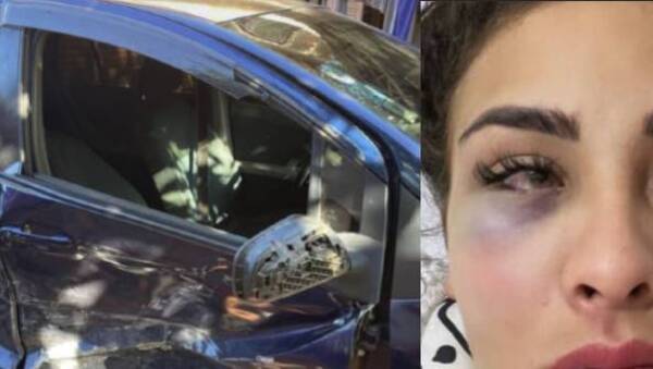 Crónica / Cantante sufrió aparatoso accidente: "Me quedé en shock"