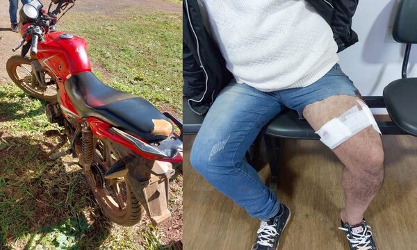 Delincuentes balean a un hombre y le roban G. 5 millones en Yguazú – Diario TNPRESS