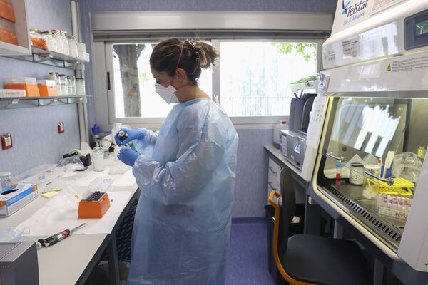 México confirma cinco casos de viruela del mono pero descarta una pandemia - Mundo - ABC Color