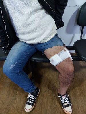 Yguazú: imputan a sospechoso de asaltar y balear a su víctima - ABC en el Este - ABC Color