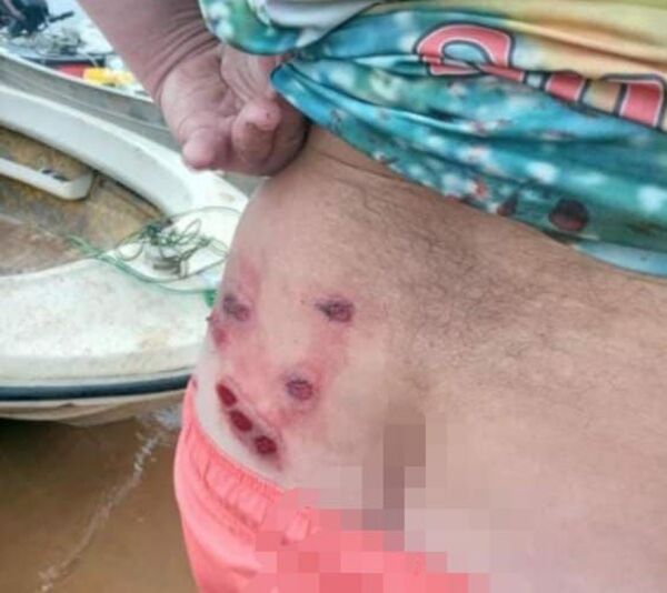 Denunciaron que agentes de la Prefectura Argentina dispararon a un pescador paraguayo - Nacionales - ABC Color