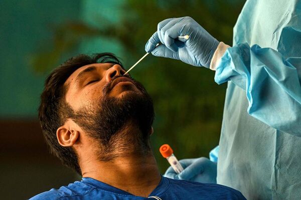 Covid e influenza en aumento: dónde hacerse el test y sus costos - Nacionales - ABC Color
