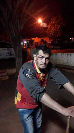 Adictos atacan brutalmente a vecinos que intentaban colocar caseta de seguridad - La Clave
