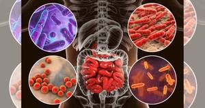 La Nación / Un estudio analiza la relación entre la dieta y el microbioma con el cáncer colorrectal