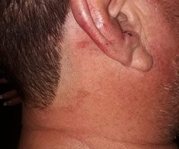 Taxista fue detenido y golpeado brutalmente por cinco marinos – Diario TNPRESS