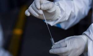 Covid-19: Pedidos de hisopados van en aumento y llegan hasta 300 por semana