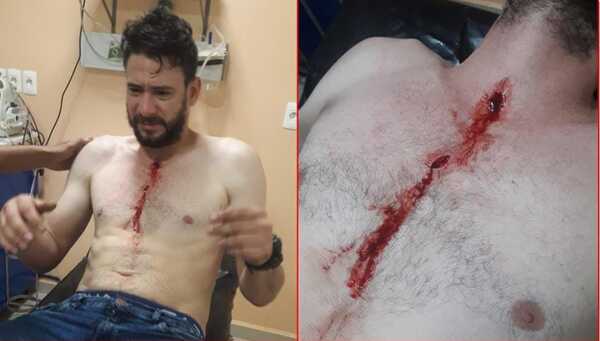 Reclamó robo de su batería y fue acuchillado