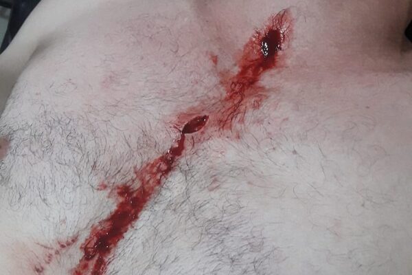 Un hombre recibe dos puñaladas tras encarar a patoteros que le robaron batería del vehículo – Diario TNPRESS