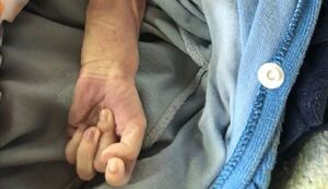 Beba muere debido a desnutrición severa y sus padres fueron imputados - Policiales - ABC Color