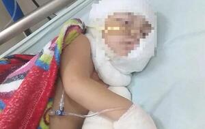 Bebé se quemó con aceite caliente y está grave en Mariano Roque Alonso – Prensa 5