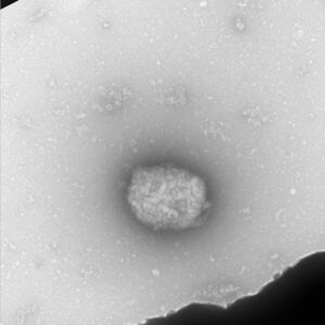 Perú confirma primer caso de viruela del mono en Lima - Mundo - ABC Color