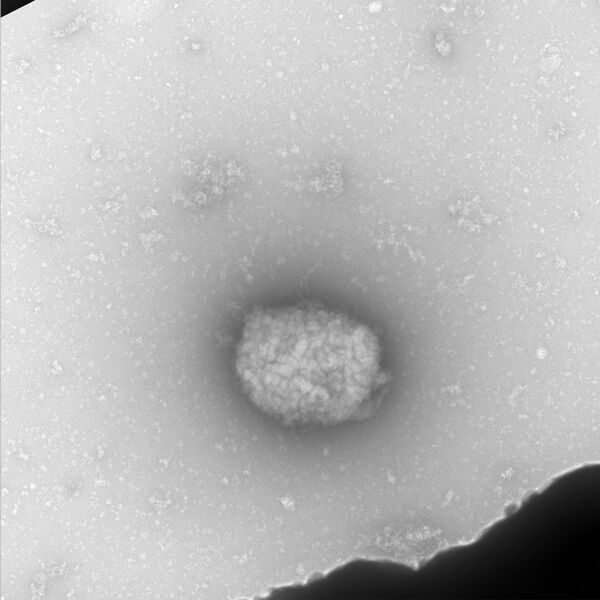 Perú confirma primer caso de viruela del mono en Lima - Mundo - ABC Color