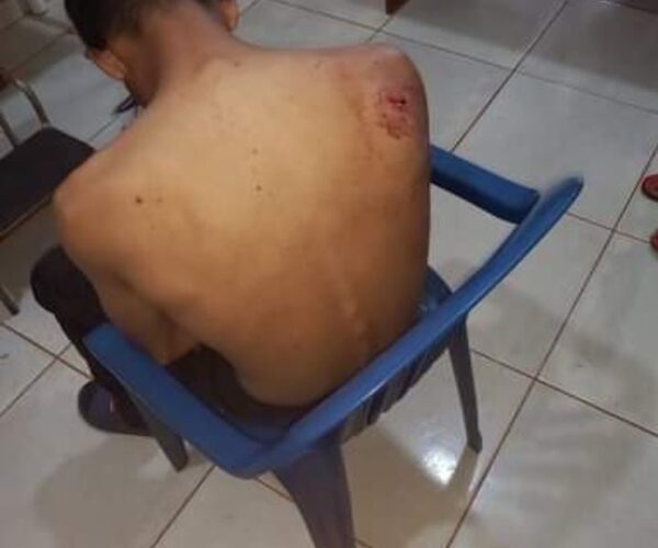 Un muchachón resultó tajeado tras una ronda de tragos