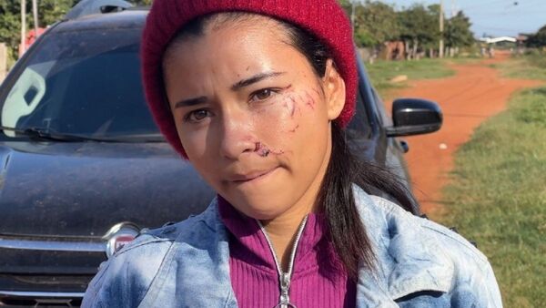 Motochorros golpean a mujer con una botella en asalto en Concepción