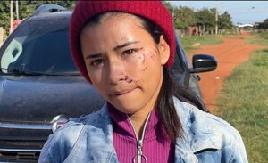 Motochorros golpean a una mujer con una botella en asalto en Concepción