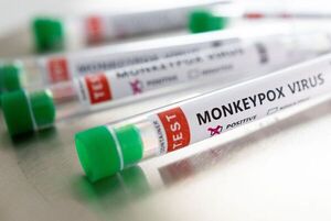 Diario HOY | OMS registra más de 3.400 casos de viruela del mono en 50 países en lo que va del año