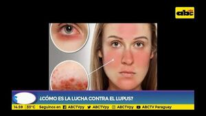 Identifican un nuevo marcador para el lupus - Estilo de vida - ABC Color