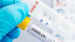Salud estima que alta demanda de test de Covid-19 se extendería por 30 días más