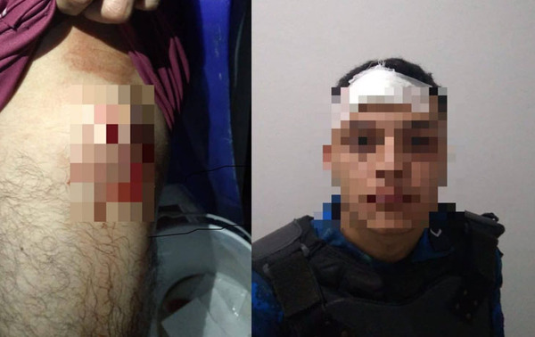 Agentes de la montada resultan heridos tras enfrentamiento entre barras de Olimpia – Prensa 5