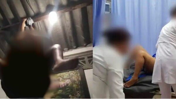 Mujer intentó realizar un famoso reto sexual de la araña y terminó en el hospital