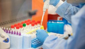 Confirman más de 5.000 nuevos casos de COVID-19 en una semana - Noticiero Paraguay
