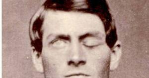 La Nación / El apasionante caso de Phineas Gage