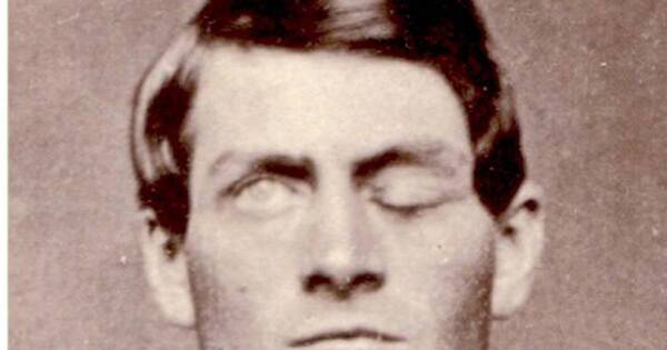 La Nación / El apasionante caso de Phineas Gage