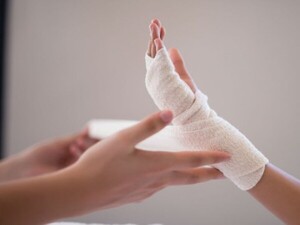 Reportan preocupante incremento de personas que sufren quemaduras - ADN Digital