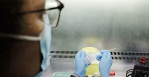 Brasil ya tiene 76 casos confirmados de la viruela del mono - Noticiero Paraguay