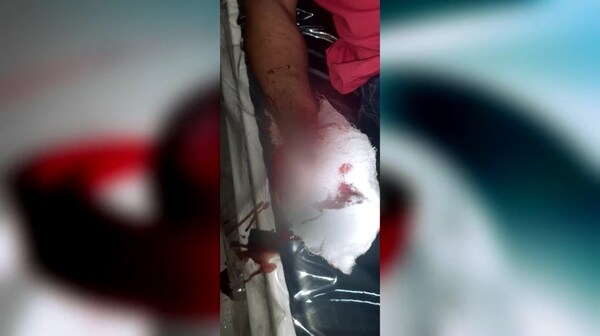 Riña en fiesta bailable deja varios heridos en Alto Verá