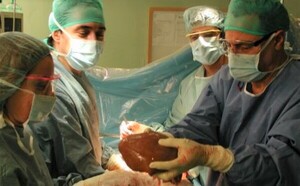 Personas trasplantadas relatan experiencia y piden donar órganos para ofrecer nueva oportunidad de vida a pacientes – La Mira Digital