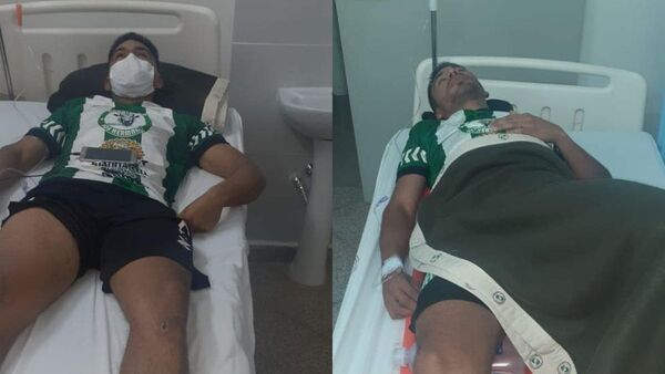 Hermanos sufrieron doble fractura en mismo partido de Liga Villetana