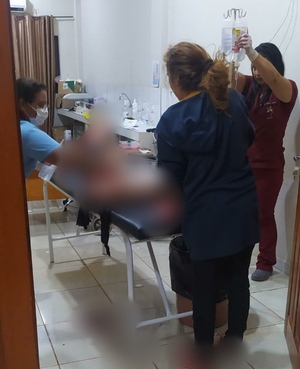 Hombre casi muere desangrado tras recibir estocada en el brazo - La Clave