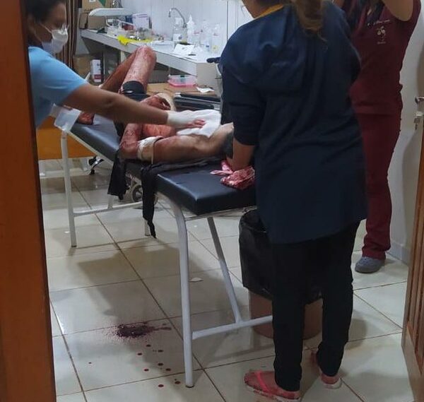 Joven es herido de una puñalada en el brazo al ser atacado en calle – Diario TNPRESS