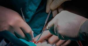 La Nación / Pacientes dializados del interior podrán seguir tratamiento en sus hogares