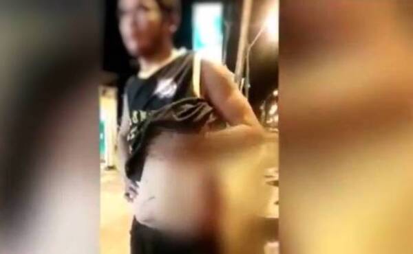Crónica / Reciclador acusa a la Policía de haberle disparado y rajado