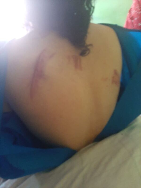 Mujer trans fue atacada a golpes en calles de Ciudad del Este - Nacionales - ABC Color