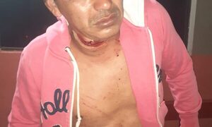 Reciclador sufre feroz herida cortante en el cuello al ser atacado por otro trabajador de la calle – Diario TNPRESS