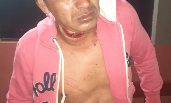 Reciclador sufre feroz herida cortante en el cuello al ser atacado por otro trabajador de la calle – Diario TNPRESS