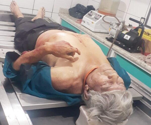 Anciano es asesinado de 17 puñaladas en Iruña y el autor está forajido – Diario TNPRESS