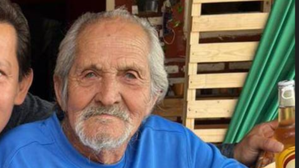 Amputaron pierna equivocada: "No hubo negligencia sino error de comunicación", dijo médico