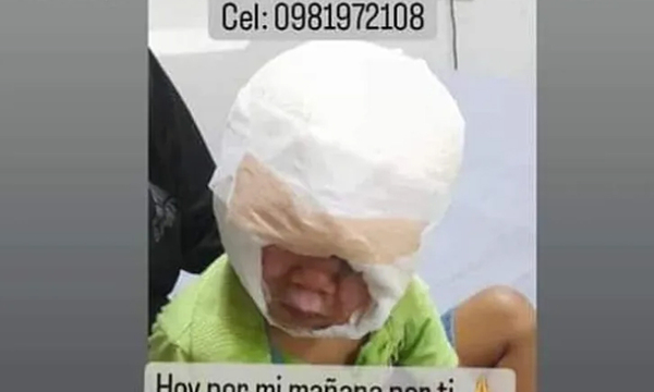 Trágico: Derramó caldo hirviendo por su hijo - OviedoPress