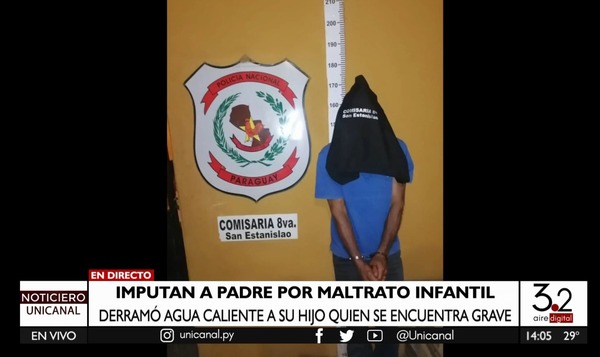 Santaní: padre derramó agua caliente a su hijo de tres años