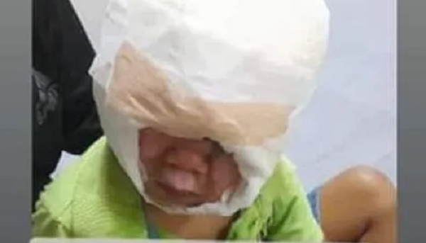 Hombre borracho derrama agua hirviendo a su pequeño de tres años - Noticiero Paraguay