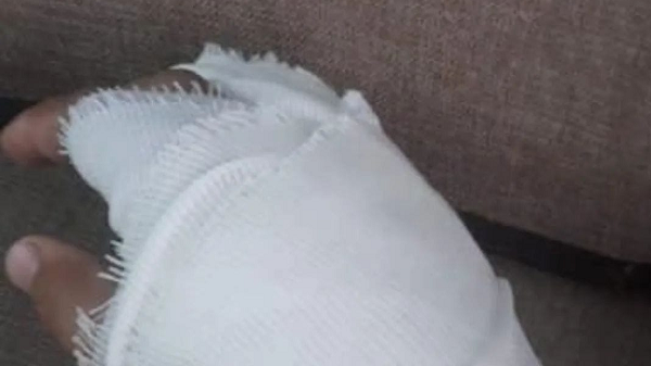 Paciente impide que médico le opere la mano equivocada en IPS - Noticiero Paraguay