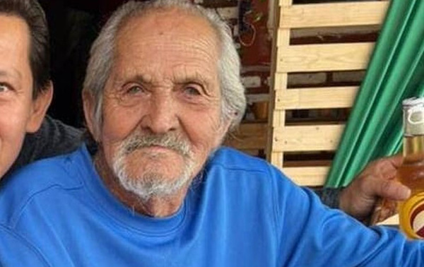 Sometieron a una tercera cirugía a abuelo de 78 años amputado en IPS – Prensa 5