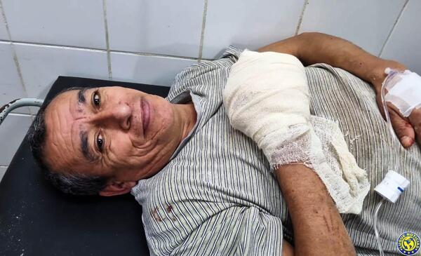 Panadero sufre un accidente laboral •
